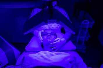 Acne Blue Light Therapy